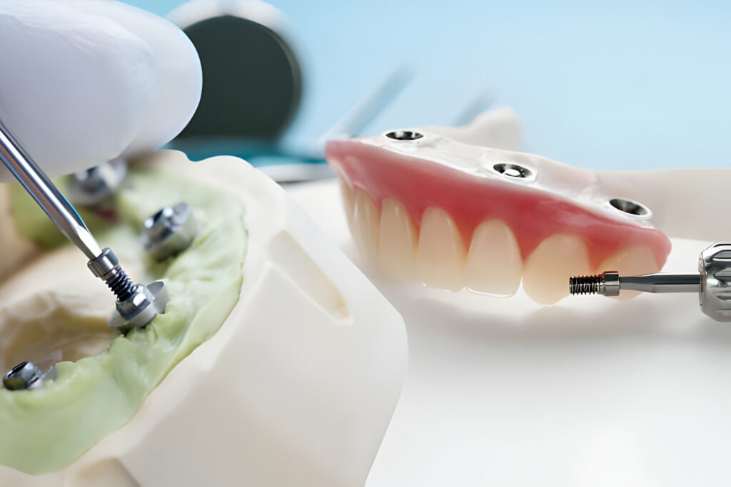 How to Care for Your Dentures and Partial Dentures: Expert Tips_2