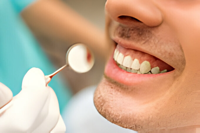 The Ultimate Guide to Orthodontics: Everything You Need to Know_FI