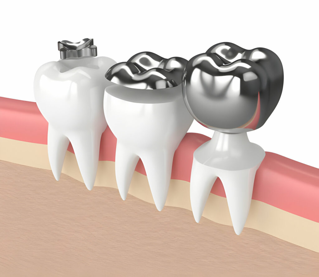 The Ultimate Guide to Orthodontics: Everything You Need to Know_2