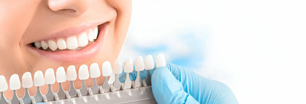 Top Reasons To Trust A Teeth-Whitening Dentist With Your Smile_3