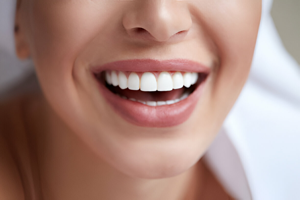 Top Reasons To Trust A Teeth-Whitening Dentist With Your Smile_FI