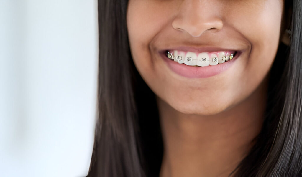 What to Expect During Your First Orthodontic Consultation_2